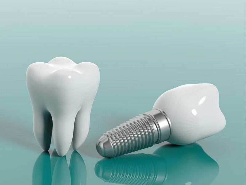 bir-gunde-implant